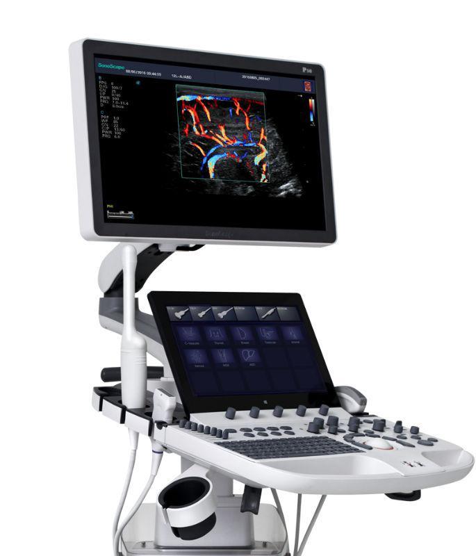 SONOGRAFO PARA RADIOLOGIA  P40 ELITE CON 4 TRANSDUCTORES SONOSCAPE