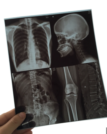 Placas para  Impresora de Rayos X - MIP1601PR