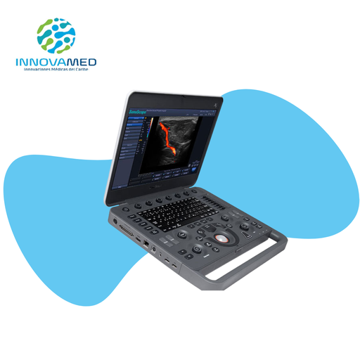 [X5] Sonógrafo Portátil Sonoscape X5